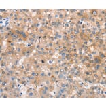 Immunohistochemistry - CRHR2 Antibody from Signalway Antibody (37504) - Antibodies.com