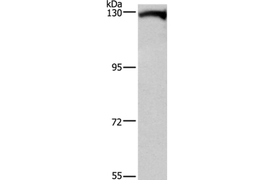 DAAM1 Antibody from Signalway Antibody (37519) - Antibodies.com