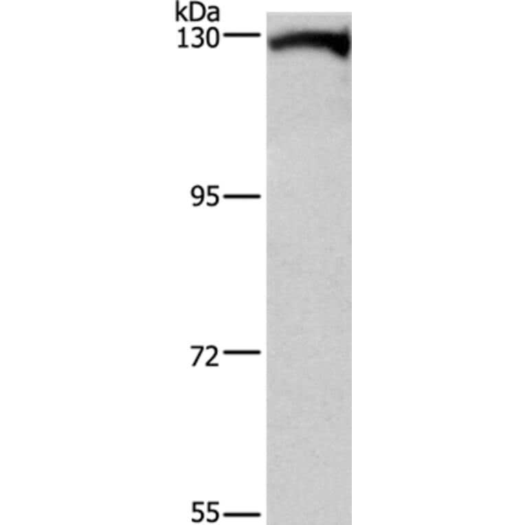 DAAM1 Antibody from Signalway Antibody (37519) - Antibodies.com
