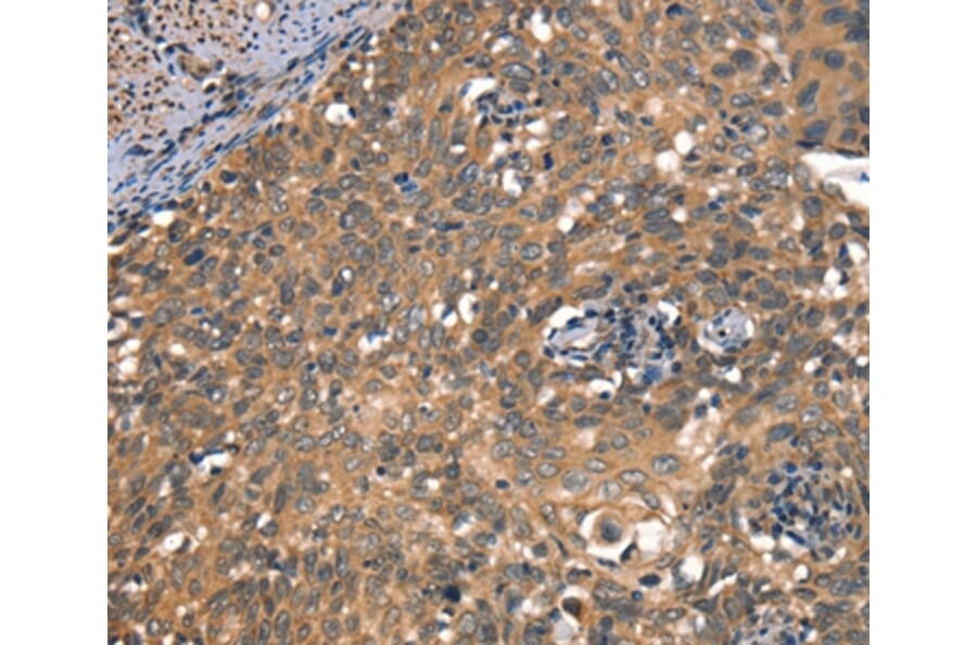 Immunohistochemistry - DAAM1 Antibody from Signalway Antibody (37519) - Antibodies.com