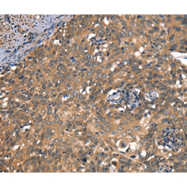Immunohistochemistry - DAAM1 Antibody from Signalway Antibody (37519) - Antibodies.com