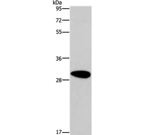 DDAH2 Antibody from Signalway Antibody (37522) - Antibodies.com