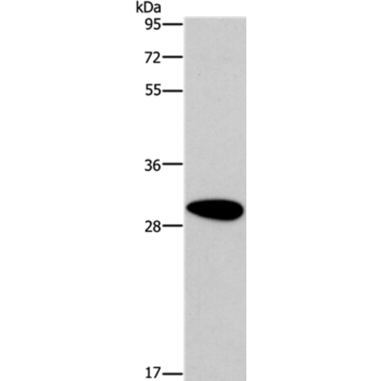 DDAH2 Antibody from Signalway Antibody (37522) - Antibodies.com