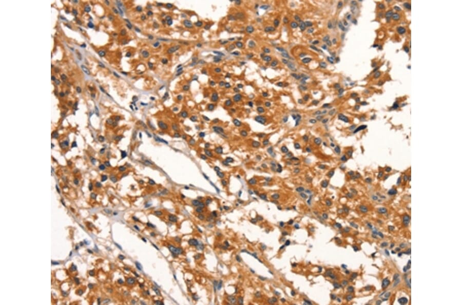 Immunohistochemistry - DDAH2 Antibody from Signalway Antibody (37522) - Antibodies.com