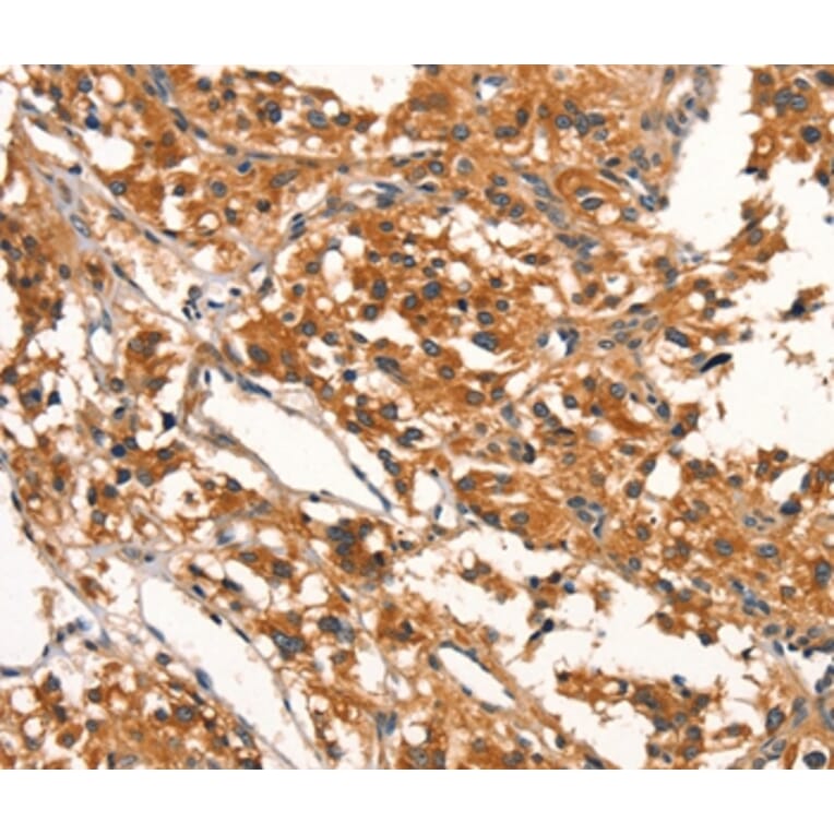 Immunohistochemistry - DDAH2 Antibody from Signalway Antibody (37522) - Antibodies.com