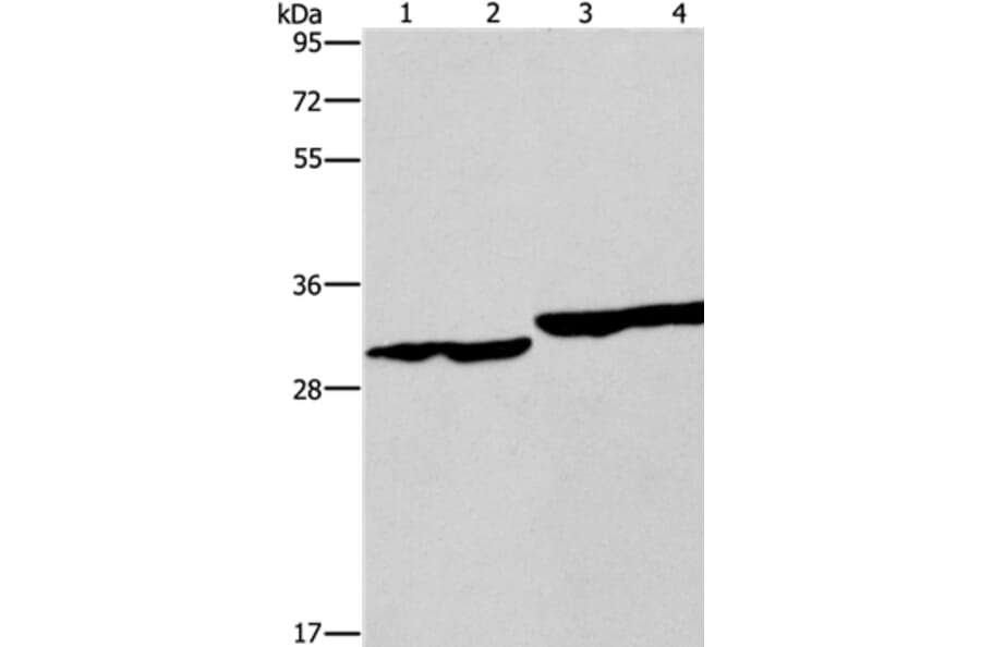 DECR1 Antibody from Signalway Antibody (37524) - Antibodies.com