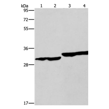 DECR1 Antibody from Signalway Antibody (37524) - Antibodies.com