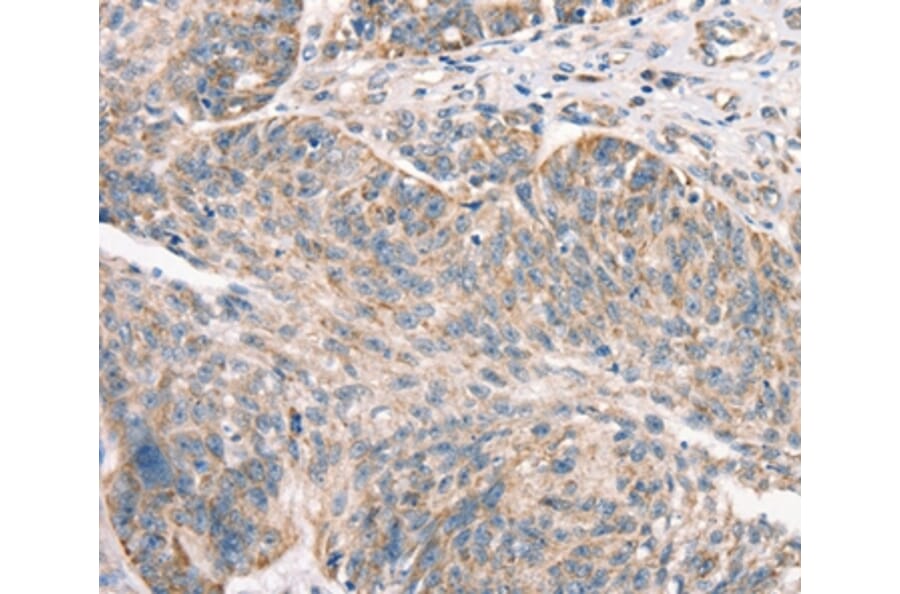 Immunohistochemistry - DECR1 Antibody from Signalway Antibody (37524) - Antibodies.com