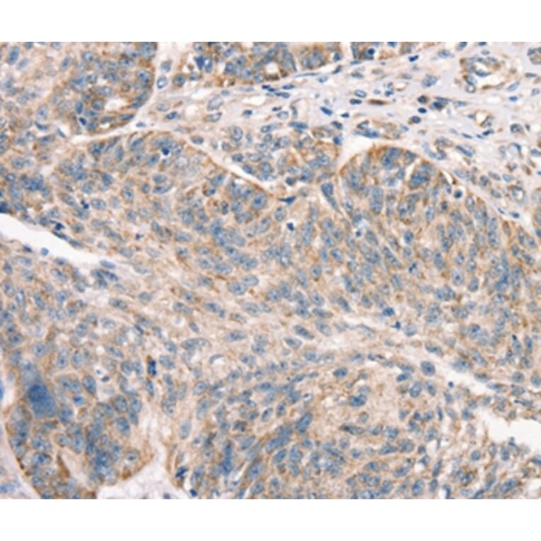 Immunohistochemistry - DECR1 Antibody from Signalway Antibody (37524) - Antibodies.com