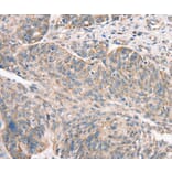 Immunohistochemistry - DECR1 Antibody from Signalway Antibody (37524) - Antibodies.com