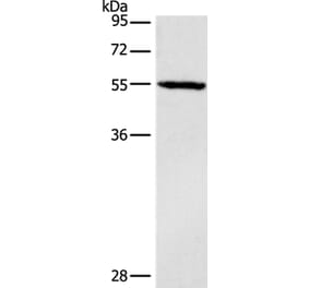 DGAT1 Antibody from Signalway Antibody (37532) - Antibodies.com