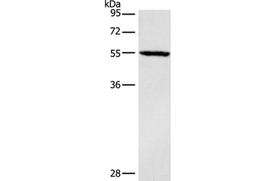 DGAT1 Antibody from Signalway Antibody (37532) - Antibodies.com