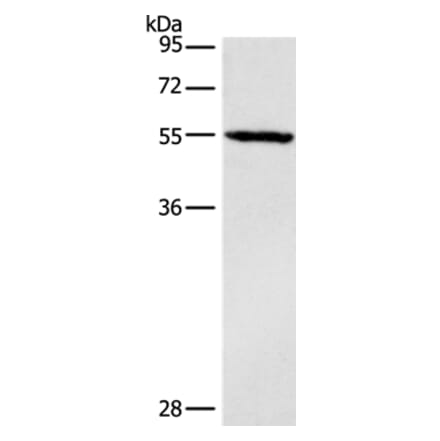 DGAT1 Antibody from Signalway Antibody (37532) - Antibodies.com