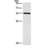 DGAT1 Antibody from Signalway Antibody (37532) - Antibodies.com