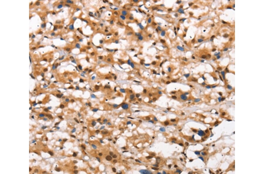 Immunohistochemistry - DGAT1 Antibody from Signalway Antibody (37532) - Antibodies.com