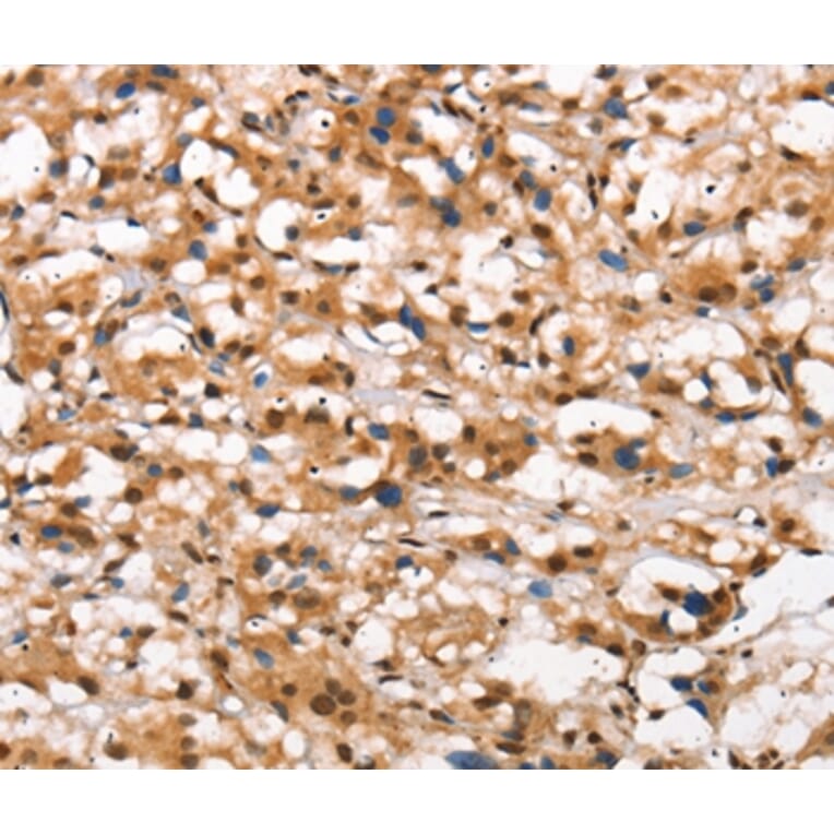 Immunohistochemistry - DGAT1 Antibody from Signalway Antibody (37532) - Antibodies.com