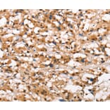 Immunohistochemistry - DGAT1 Antibody from Signalway Antibody (37532) - Antibodies.com