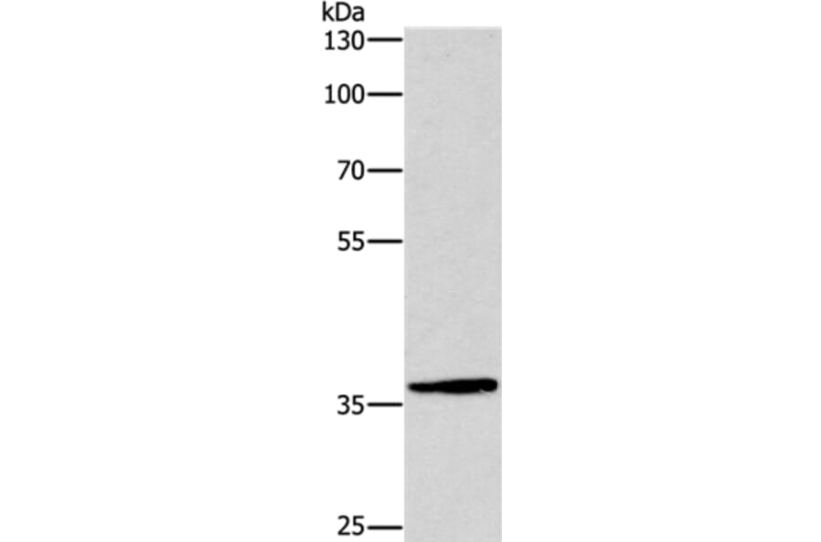 DUSP2 Antibody from Signalway Antibody (37540) - Antibodies.com