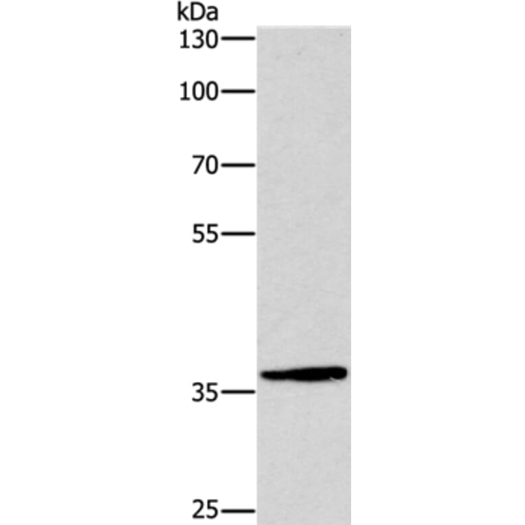 DUSP2 Antibody from Signalway Antibody (37540) - Antibodies.com