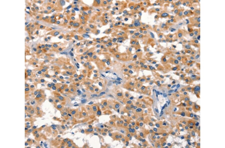 Immunohistochemistry - DUSP2 Antibody from Signalway Antibody (37540) - Antibodies.com