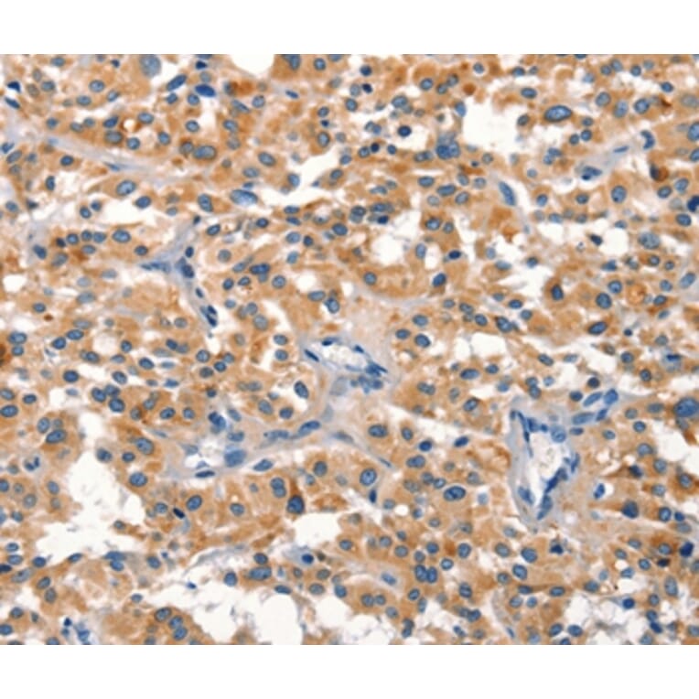 Immunohistochemistry - DUSP2 Antibody from Signalway Antibody (37540) - Antibodies.com
