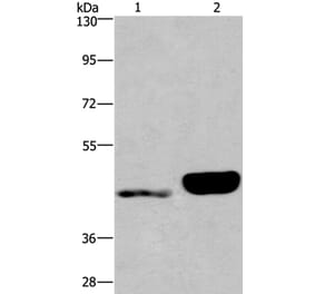 ENPP4 Antibody from Signalway Antibody (37549) - Antibodies.com