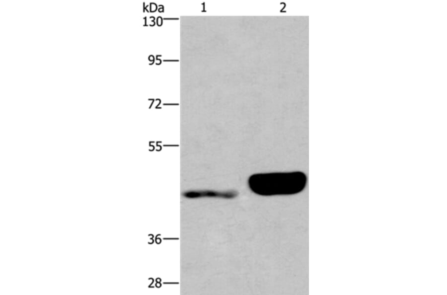 ENPP4 Antibody from Signalway Antibody (37549) - Antibodies.com