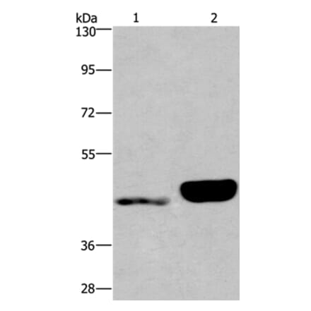 ENPP4 Antibody from Signalway Antibody (37549) - Antibodies.com