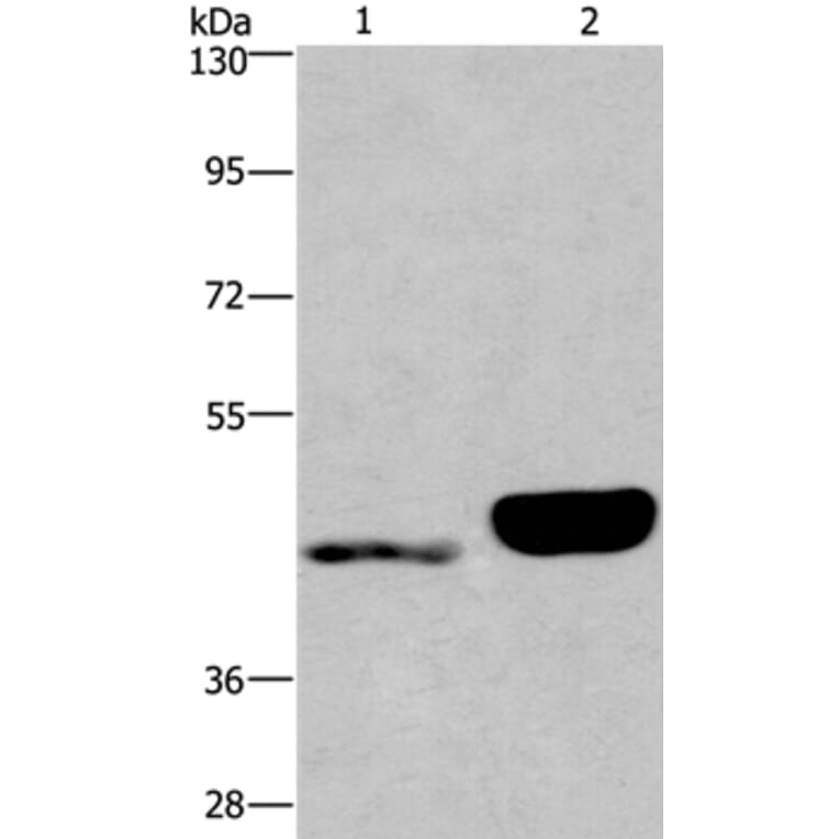 ENPP4 Antibody from Signalway Antibody (37549) - Antibodies.com