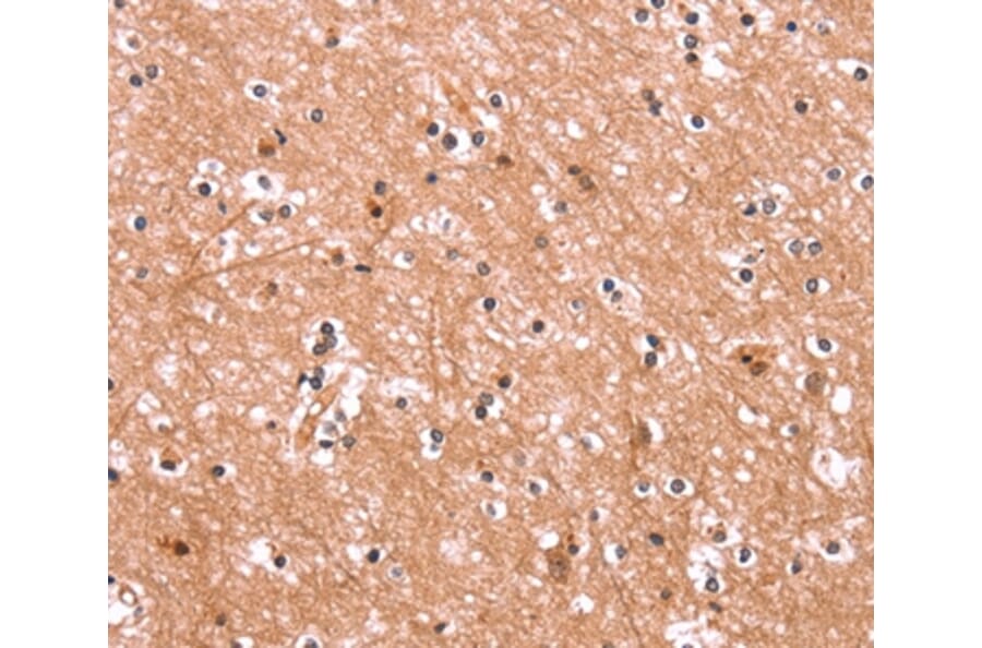 Immunohistochemistry - ENPP4 Antibody from Signalway Antibody (37549) - Antibodies.com