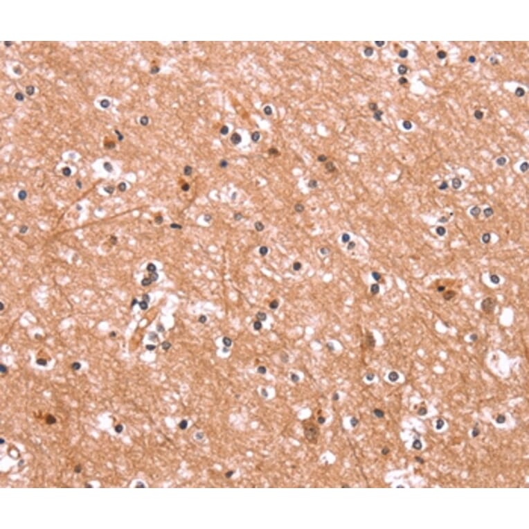 Immunohistochemistry - ENPP4 Antibody from Signalway Antibody (37549) - Antibodies.com