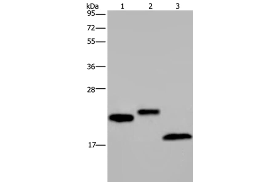 EPPIN Antibody from Signalway Antibody (37552) - Antibodies.com