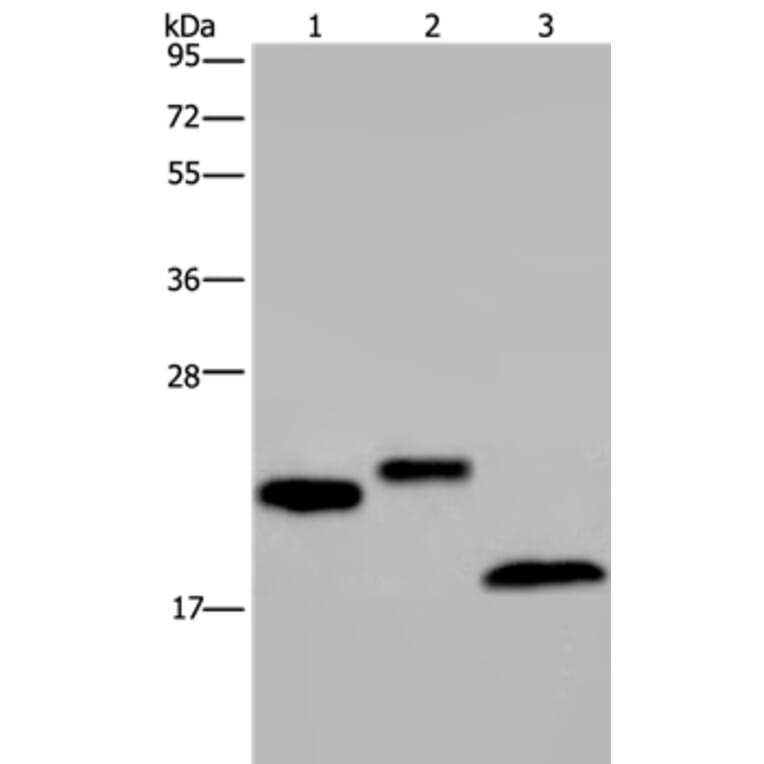 EPPIN Antibody from Signalway Antibody (37552) - Antibodies.com