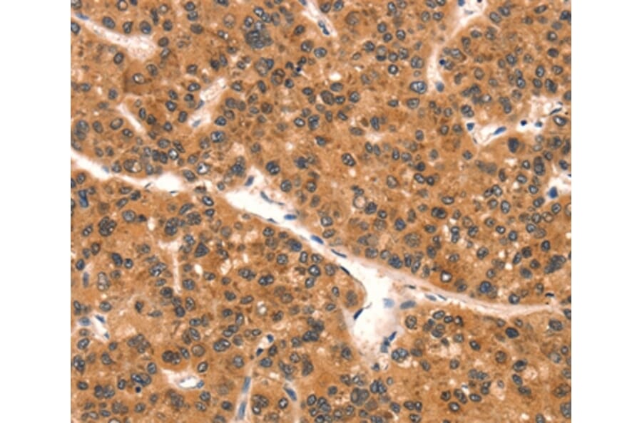 Immunohistochemistry - EPPIN Antibody from Signalway Antibody (37552) - Antibodies.com