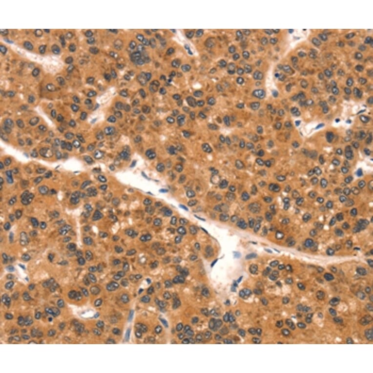 Immunohistochemistry - EPPIN Antibody from Signalway Antibody (37552) - Antibodies.com
