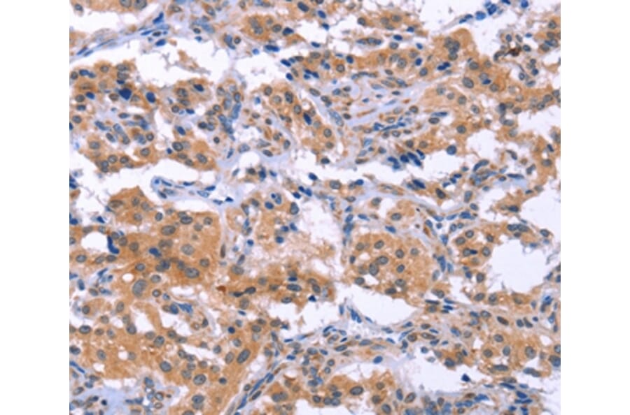 Immunohistochemistry - ESPL1 Antibody from Signalway Antibody (37557) - Antibodies.com