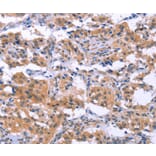 Immunohistochemistry - ESPL1 Antibody from Signalway Antibody (37557) - Antibodies.com