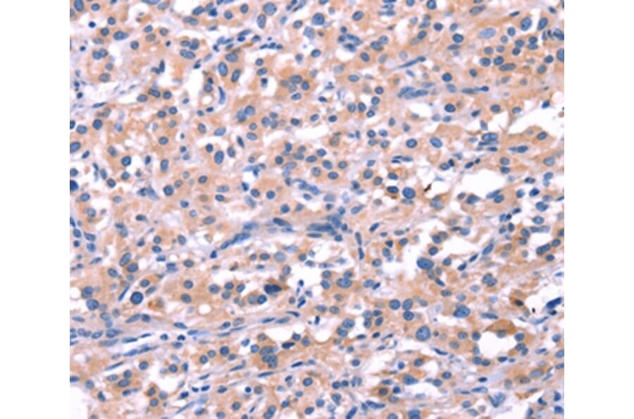 Immunohistochemistry - FEM1B Antibody from Signalway Antibody (37569) - Antibodies.com