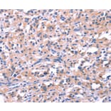 Immunohistochemistry - FEM1B Antibody from Signalway Antibody (37569) - Antibodies.com