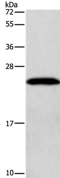 Gel: 10% SDS-PAGE Lysate: 40ug K562 cell Primary antibody: 1/200 dilution Secondary antibody dilution: 1/8000 Exposure time: 20 seconds