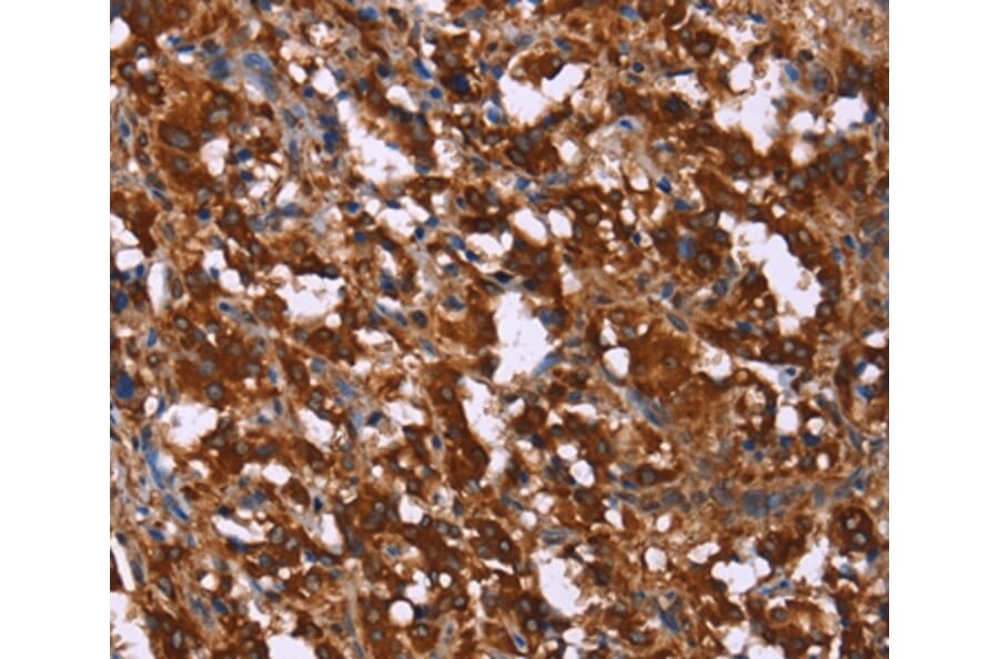 Immunohistochemistry - GAGE7 Antibody from Signalway Antibody (37585) - Antibodies.com