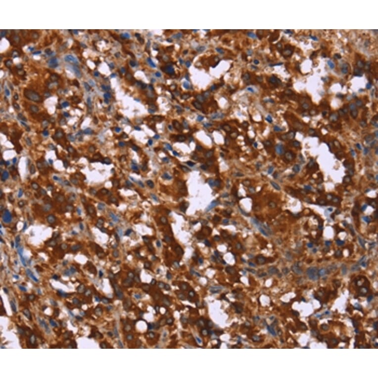 Immunohistochemistry - GAGE7 Antibody from Signalway Antibody (37585) - Antibodies.com