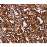 Immunohistochemistry - GAGE7 Antibody from Signalway Antibody (37585) - Antibodies.com