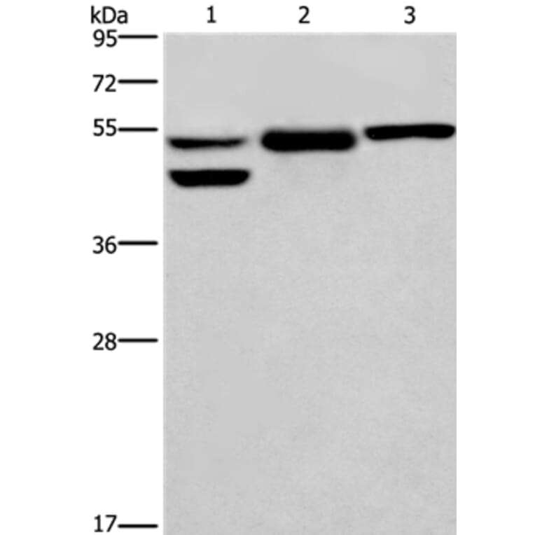 GPER1 Antibody from Signalway Antibody (37606) - Antibodies.com