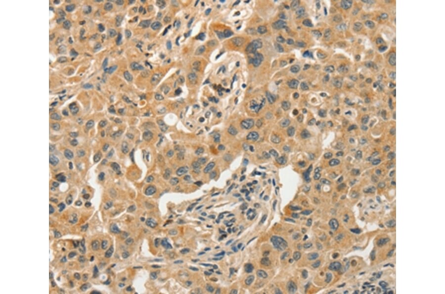 Immunohistochemistry - GPER1 Antibody from Signalway Antibody (37606) - Antibodies.com