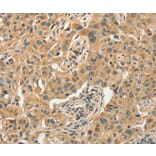 Immunohistochemistry - GPER1 Antibody from Signalway Antibody (37606) - Antibodies.com