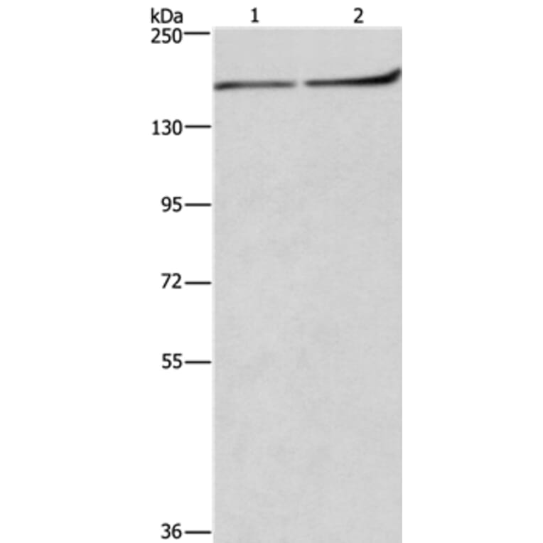 HDLBP Antibody from Signalway Antibody (37615) - Antibodies.com