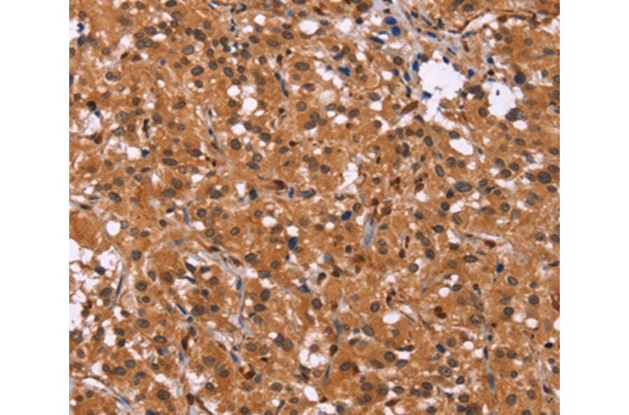 Immunohistochemistry - HDLBP Antibody from Signalway Antibody (37615) - Antibodies.com
