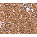 Immunohistochemistry - HDLBP Antibody from Signalway Antibody (37615) - Antibodies.com