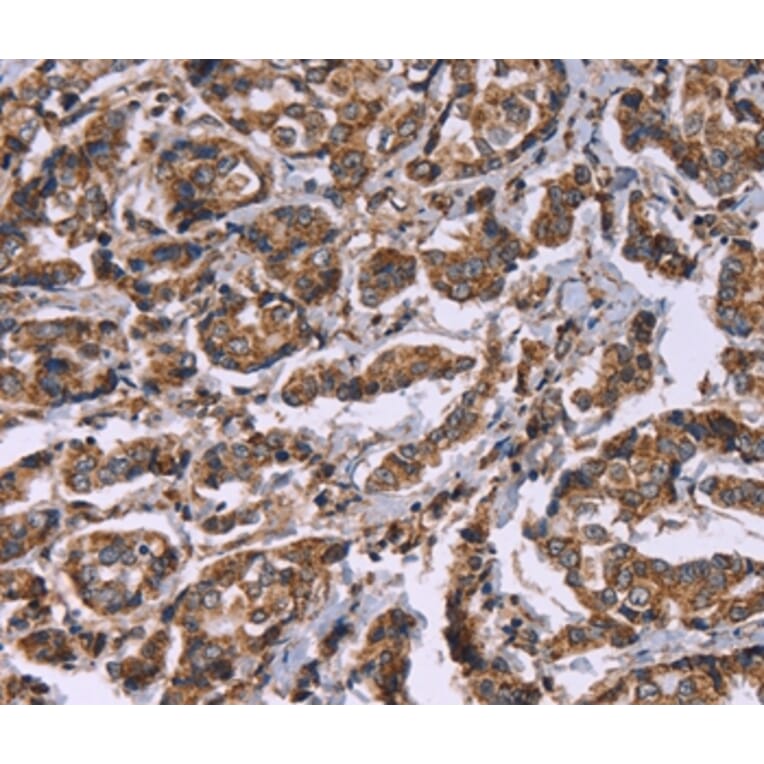 Immunohistochemistry - HSPE1 Antibody from Signalway Antibody (37636) - Antibodies.com